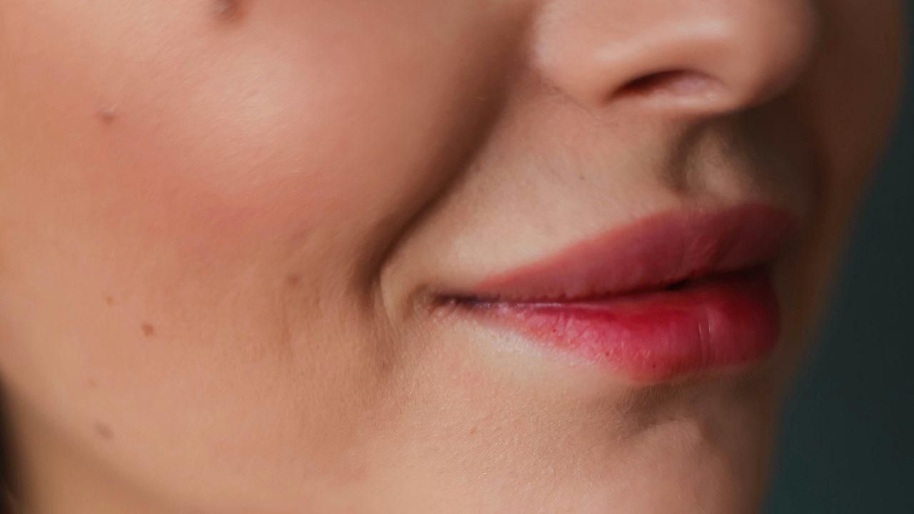 Qual o melhor bioestimulador de colágeno para o rosto