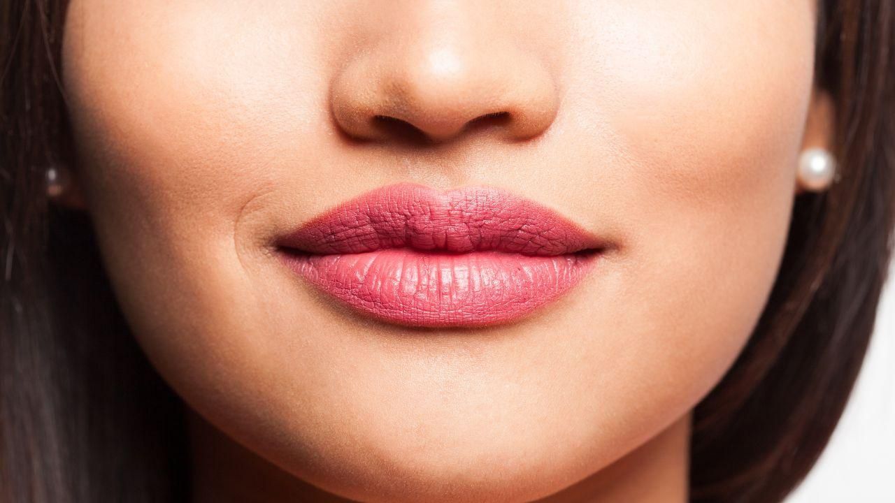 Lip lift