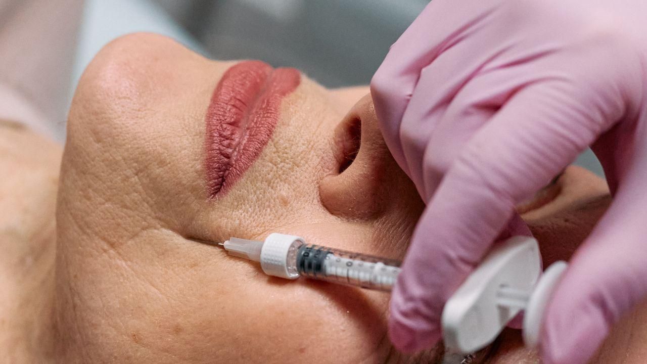 botox no rosto