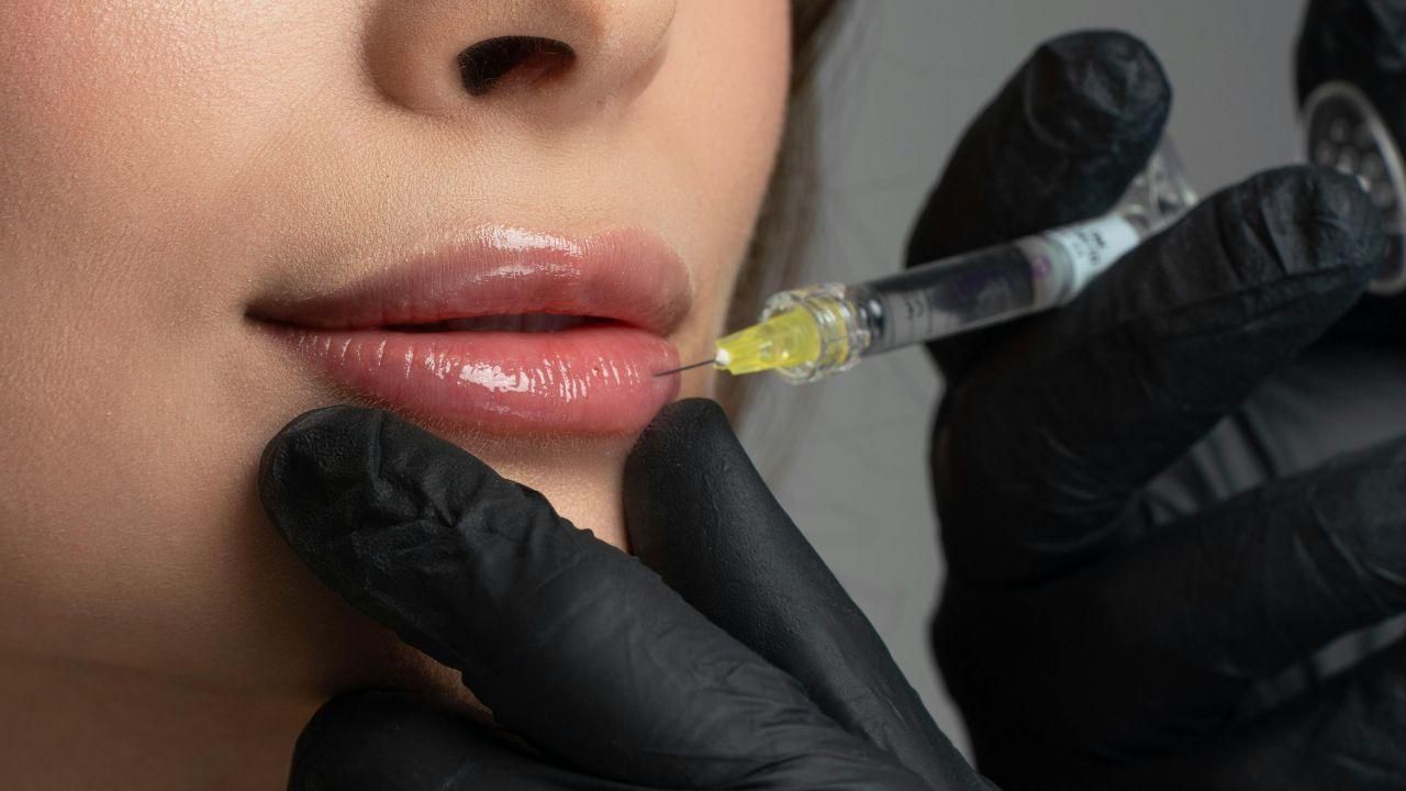 Preenchimento Labial