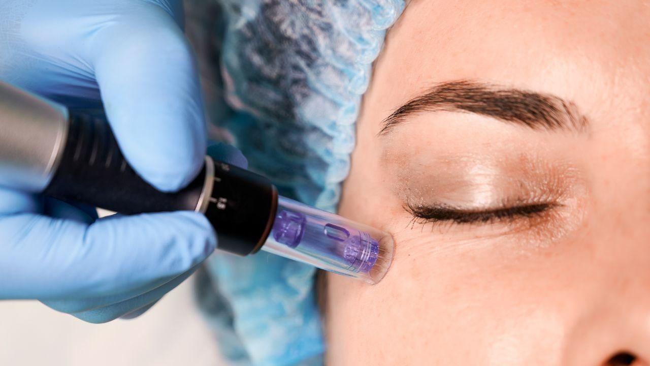 Dermapen