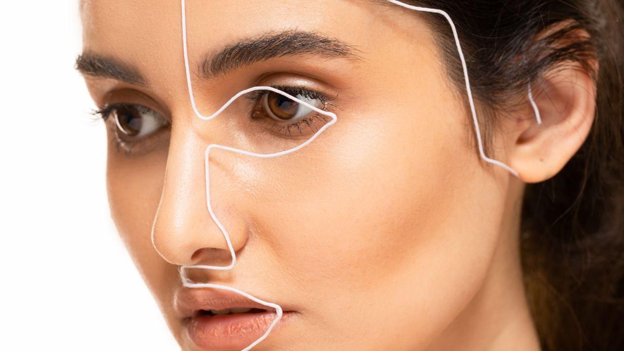 botox preventivo