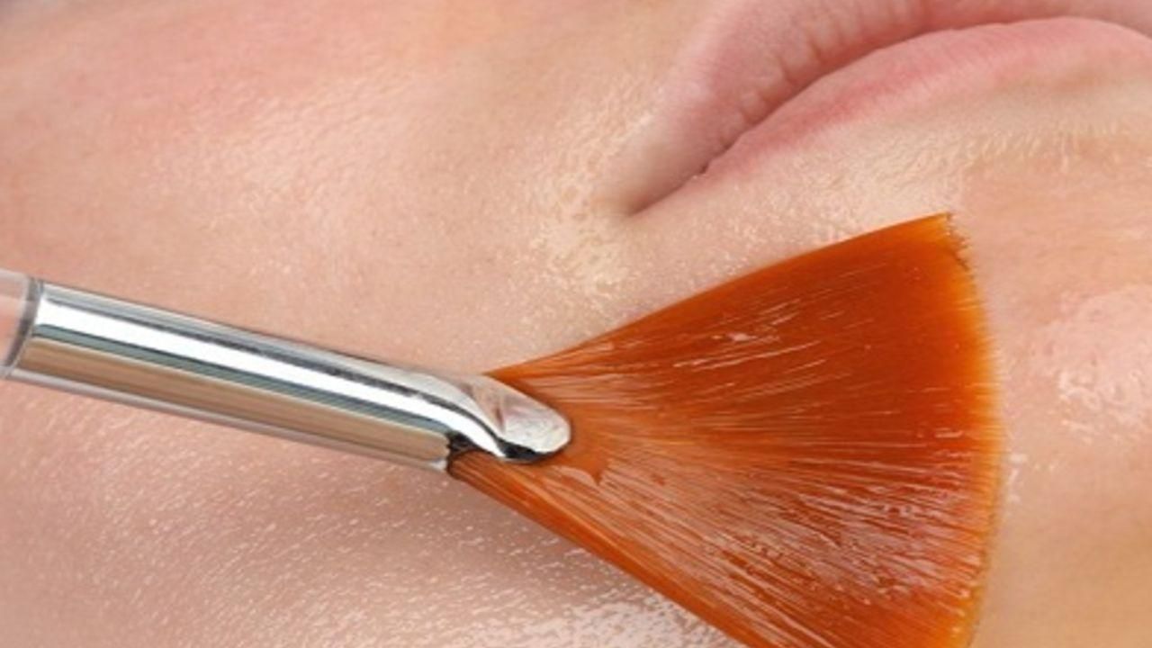 peeling químico
