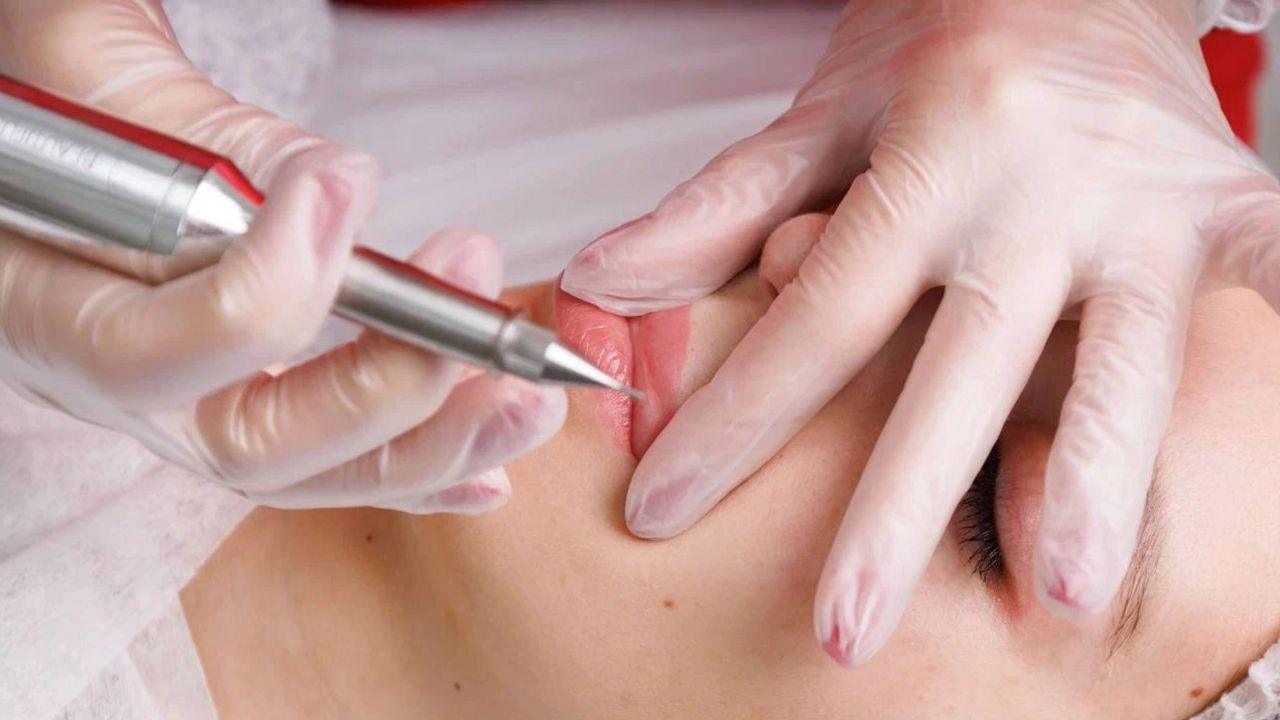 1 ml de preenchimento labial antes e depois 1 ml de preenchimento labial antes e depois