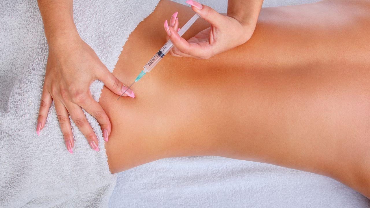 benefícios do bioestimulador de colágeno corporal benefícios do bioestimulador de colágeno corporal
