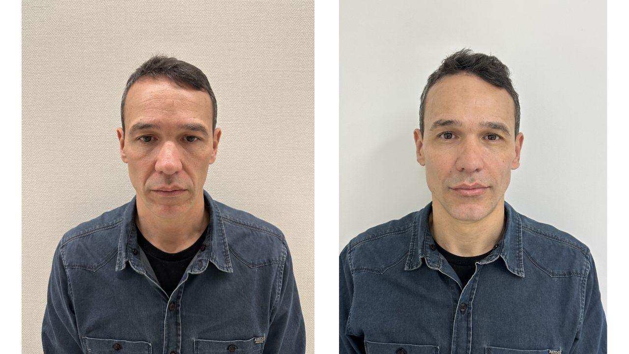 full face antes e depois full face antes e depois