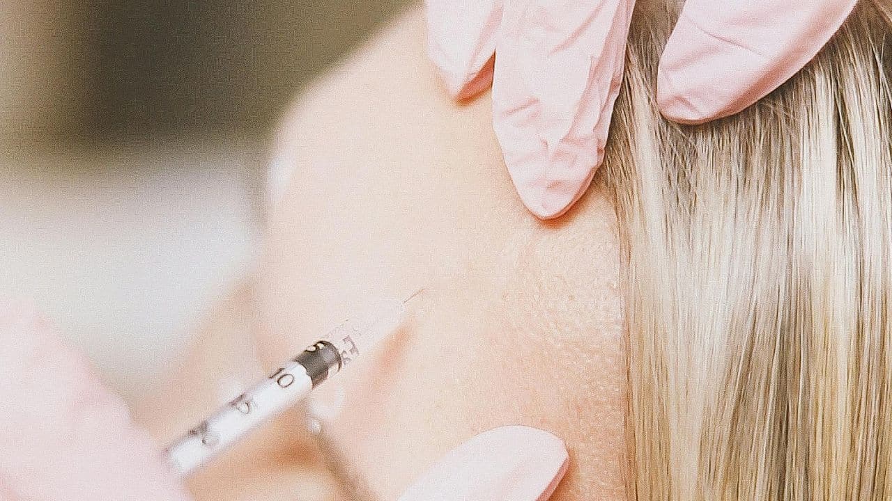 harmonização facial antes e depois