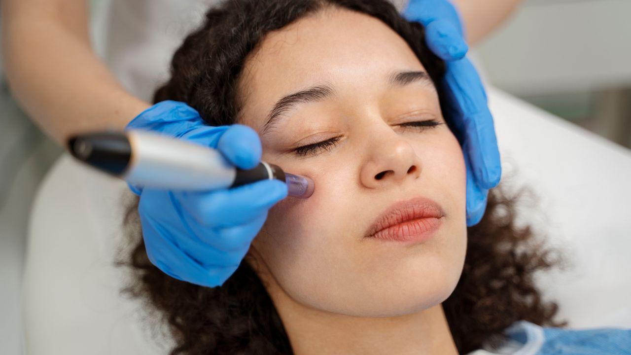 o que é peeling de diamante o que é peeling de diamante