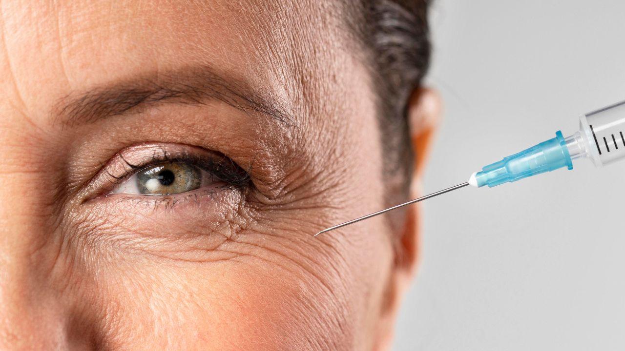 o que é toxina botulínica o que é toxina botulínica
