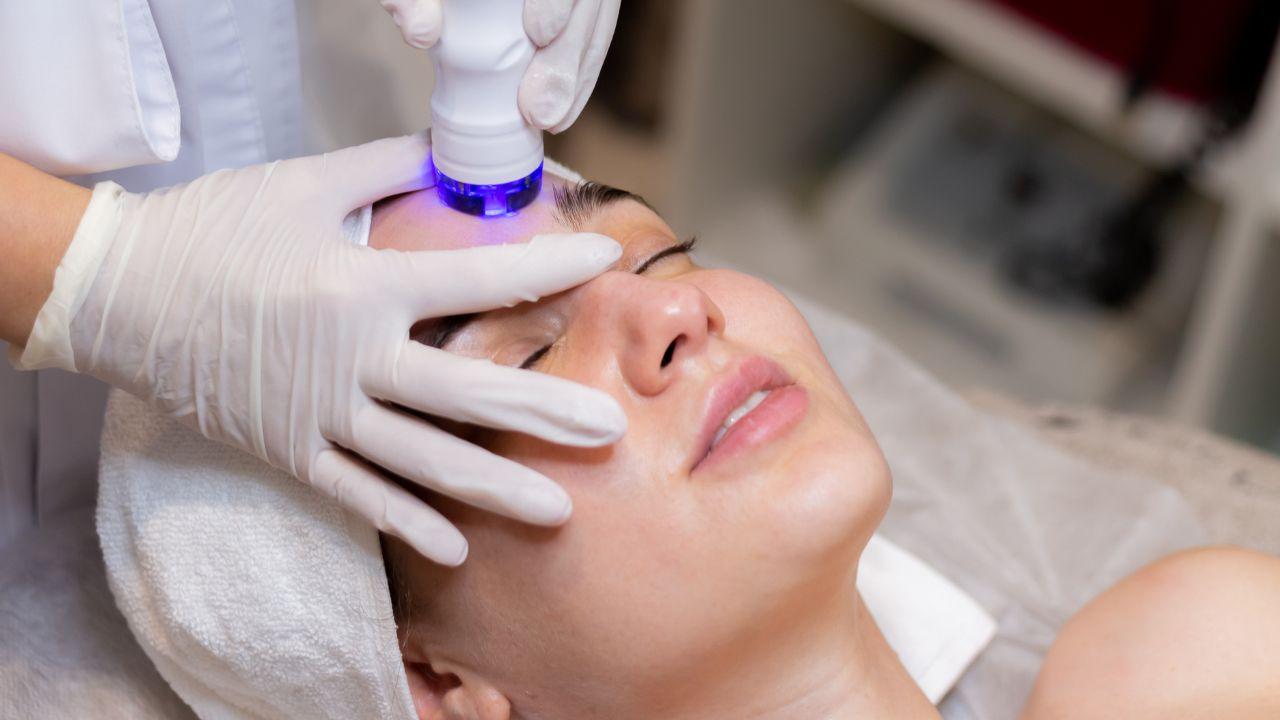 radiofrequência facial antes e depois radiofrequência facial antes e depois