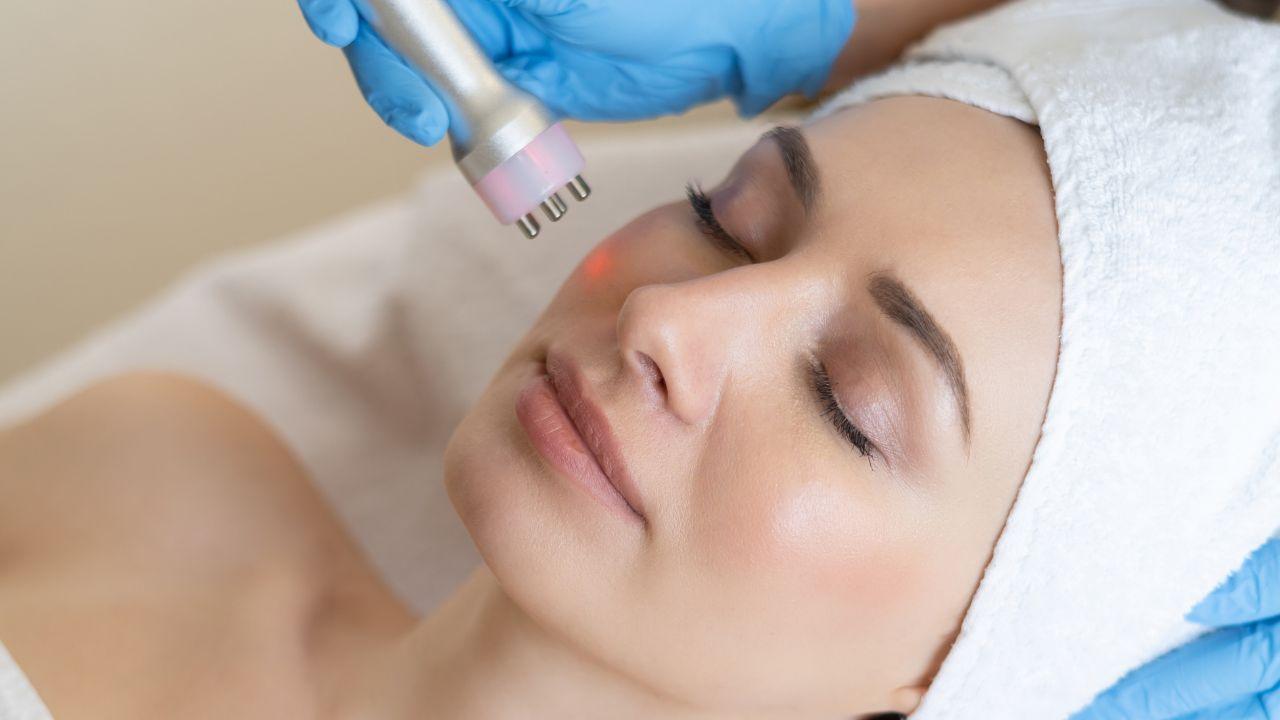 radiofrequência facial radiofrequência facial