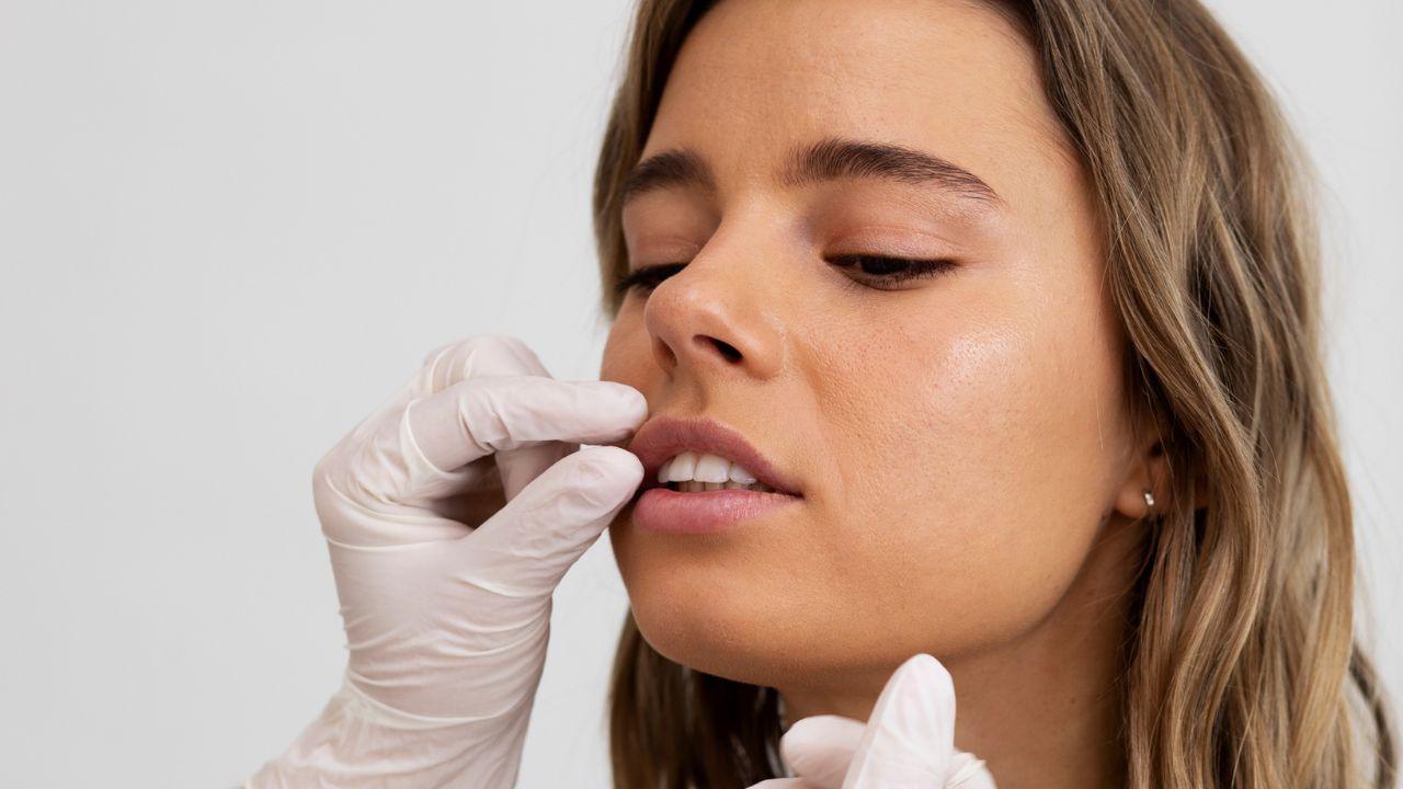 revitalização labial antes e depois revitalização labial antes e depois