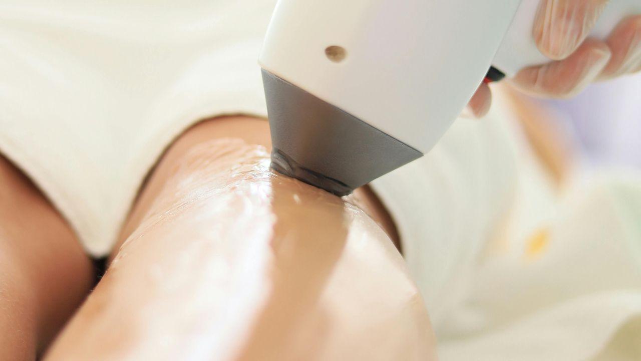 ultrassom microfocado preço ultrassom microfocado preço