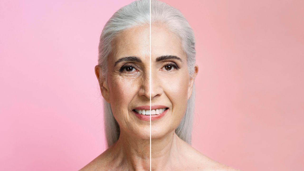Rejuvenescimento da face Rejuvenescimento da face