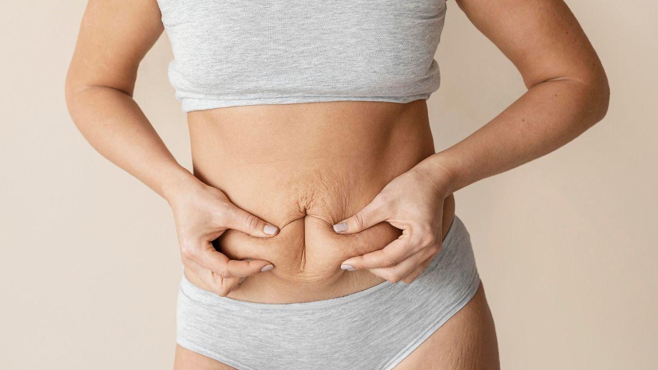 flacidez na barriga flacidez na barriga