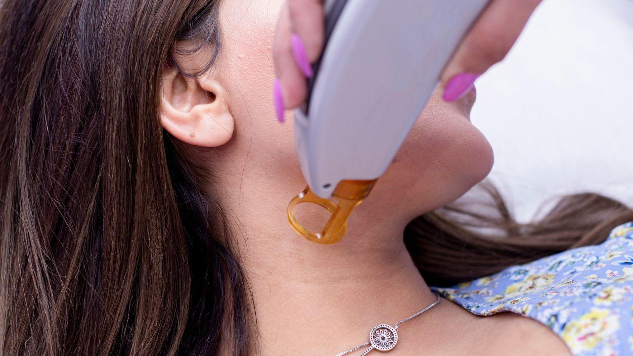 laser fracionado co2 preço laser fracionado co2 preço