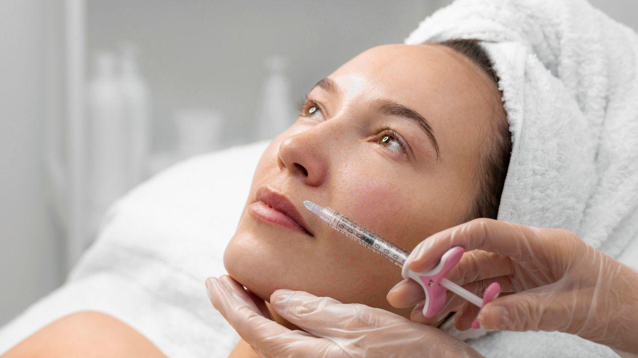 sculptra antes e depois sculptra antes e depois