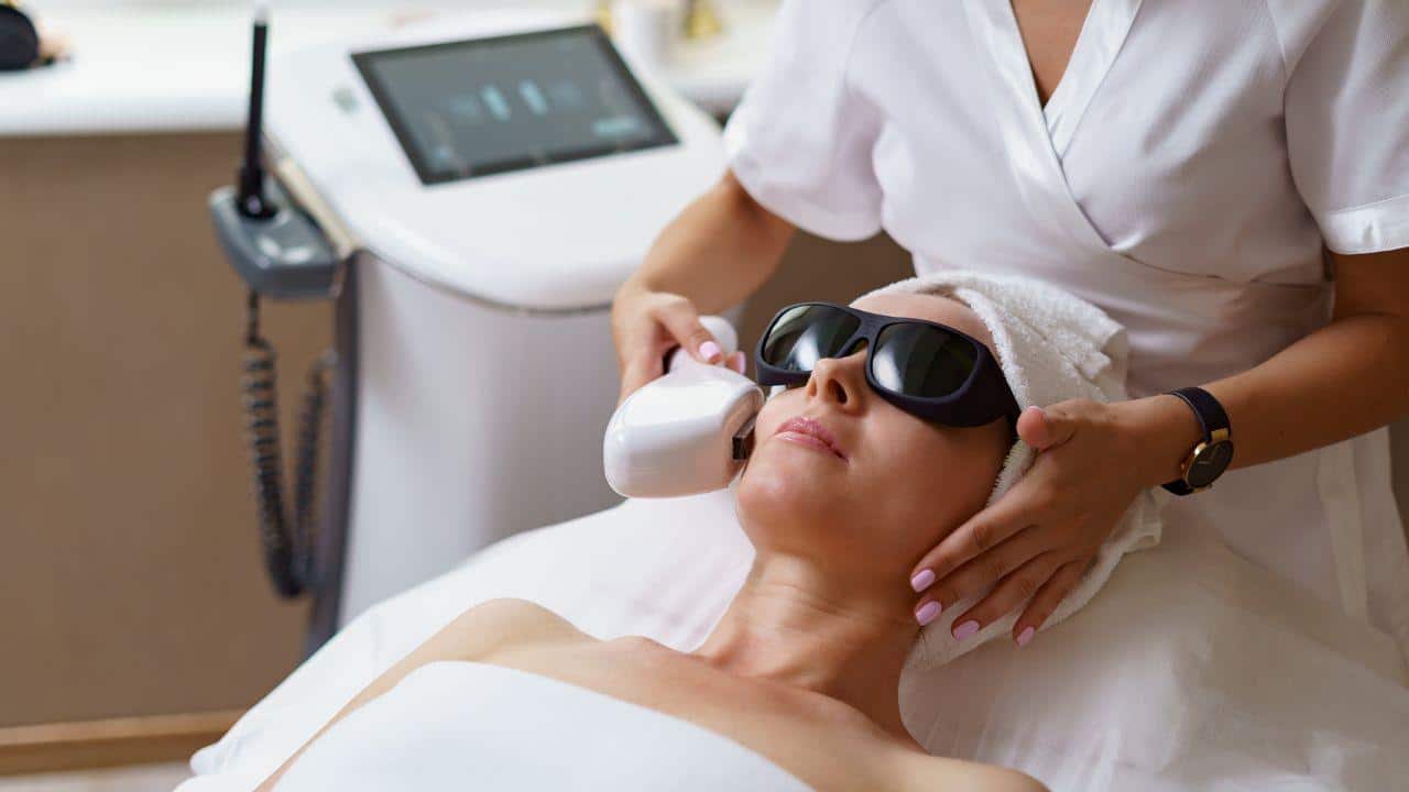 tratamento de melasma com laser tratamento de melasma com laser
